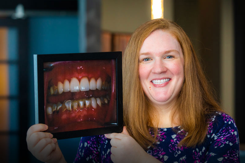 Crystal, AFull Arch Dental Patient, Smiling With Her New Teeth