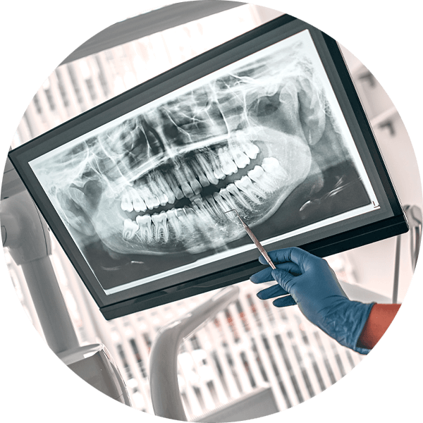 dental xray