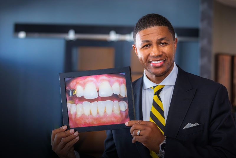 Derrick, A Full Mouth Cosmetic Restoration Patient, Smiling With A Before And After Photo