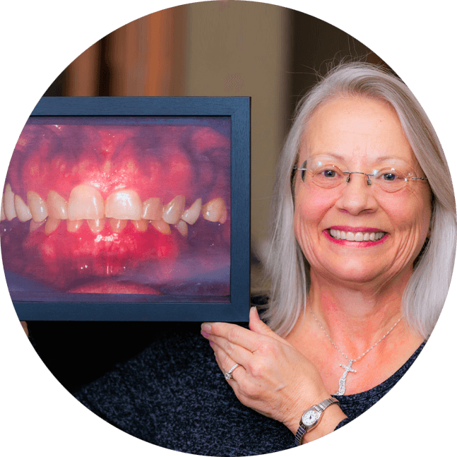 Stephanie, A Dental Implant And Full Mouth Restoration Patient