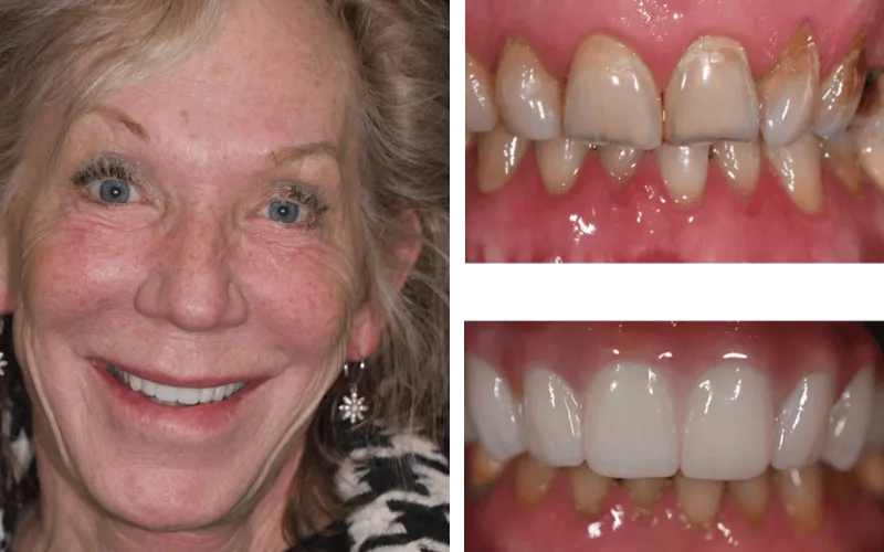 allon4fixedbridge tabor1