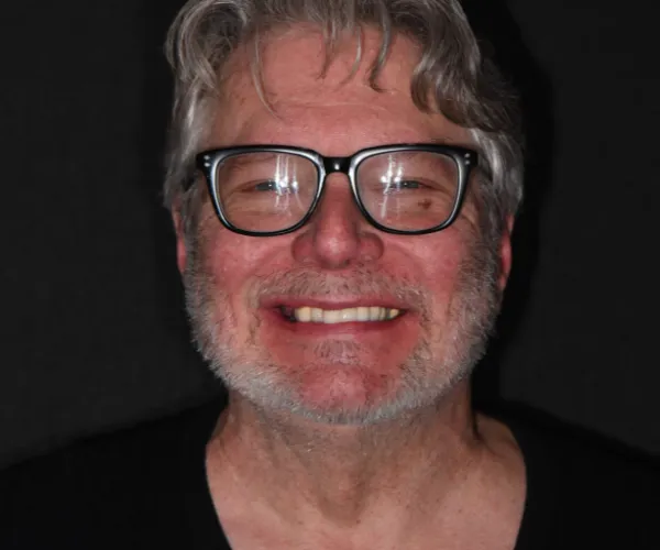 bob g fixed implants pick whatever combo you like best 4 1536x1024