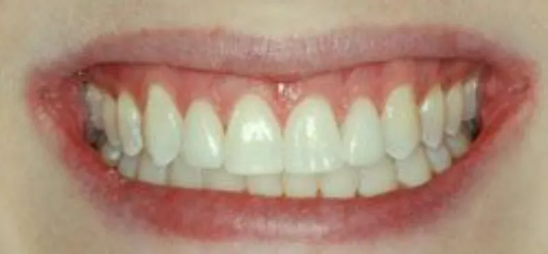 clients tabor assets images gallery after 1