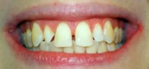 clients tabor assets images gallery before 1