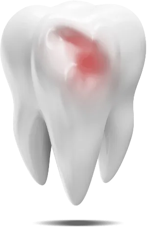 damaged tooth graphic