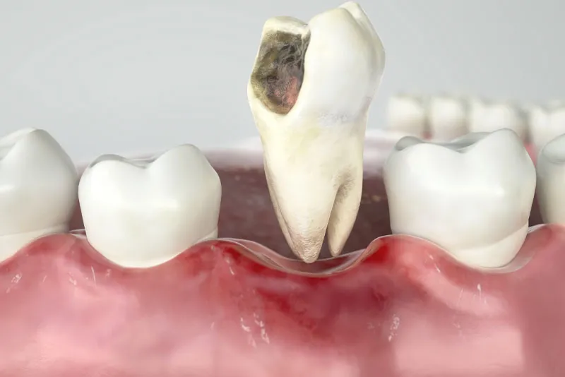 damanged tooth graphic