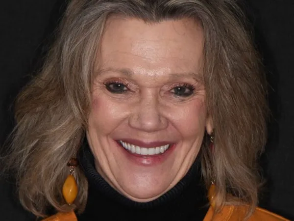 dental implants after 1