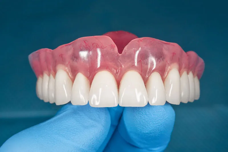 full dentures (1)
