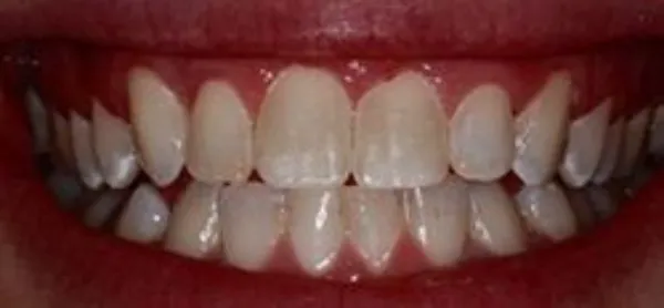 orthodontics after 1