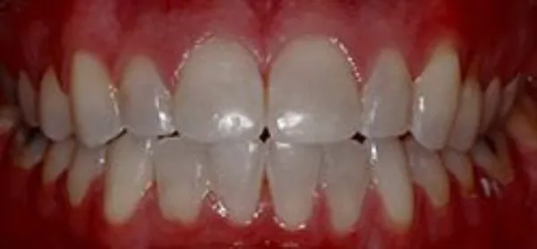 orthodontics after 2