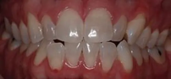 orthodontics before 2