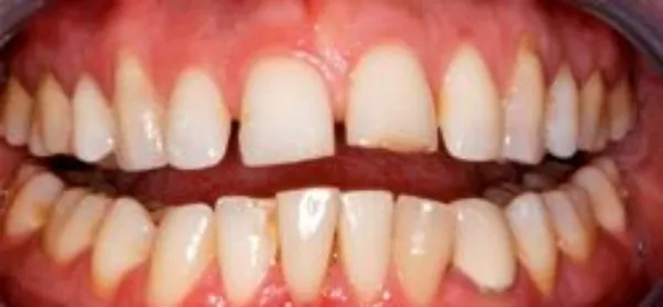 orthodontics before 4