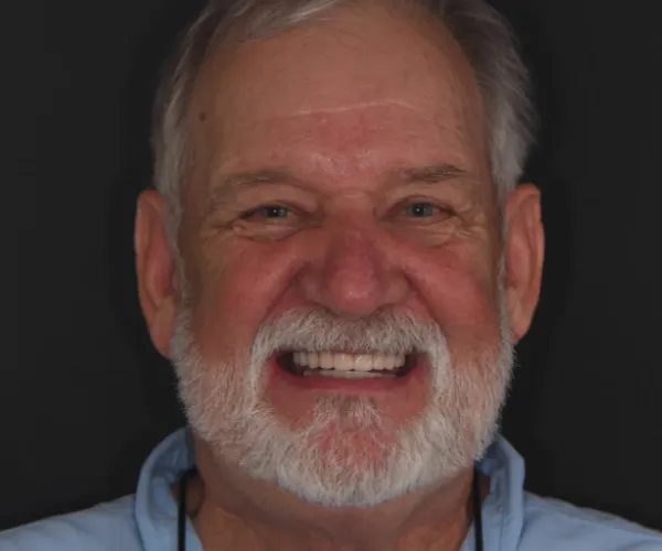 steve m after 1536x1024