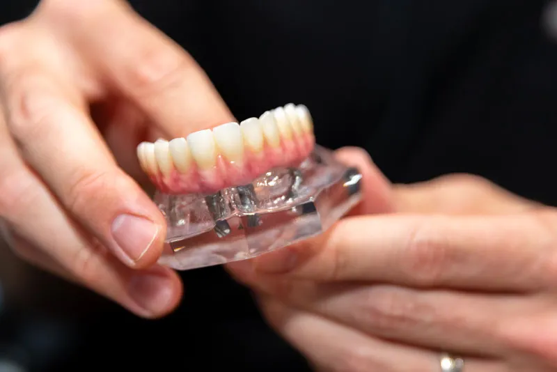 denture s1