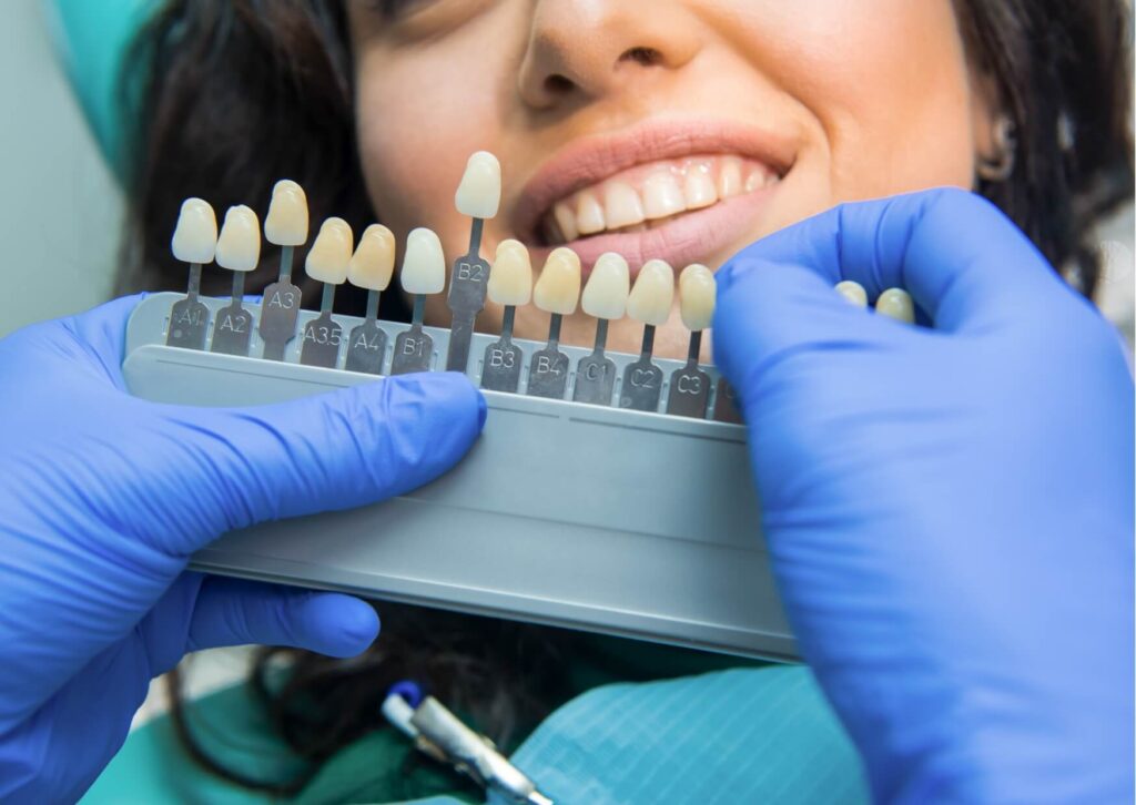 Dentist comparing tooth shades with a smile shade guide before evaluating the effectiveness of teeth whitening strips.