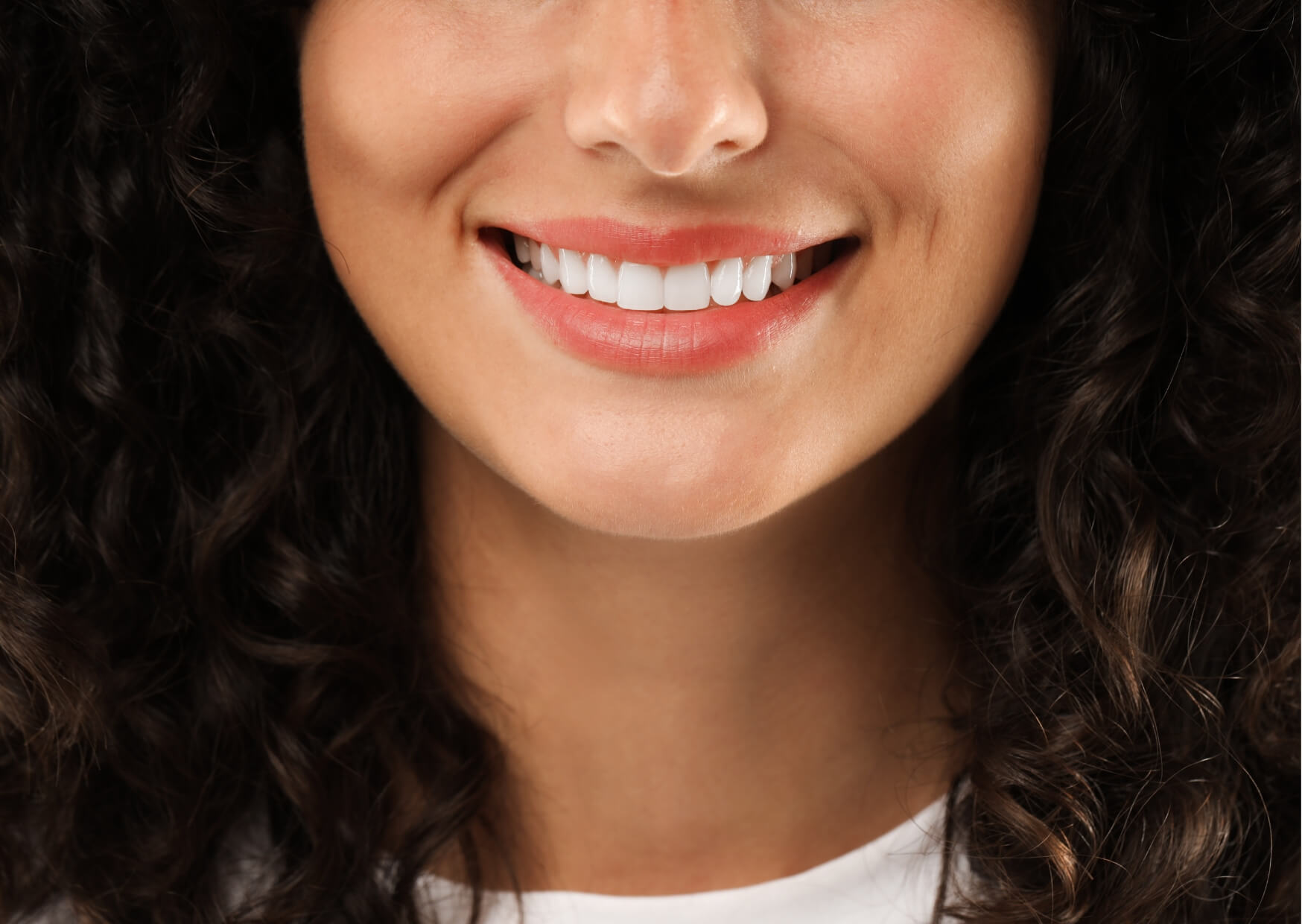 Close-up of a bright smile with porcelain veneers illustrating the long-lasting results of permanent cosmetic dental treatment.