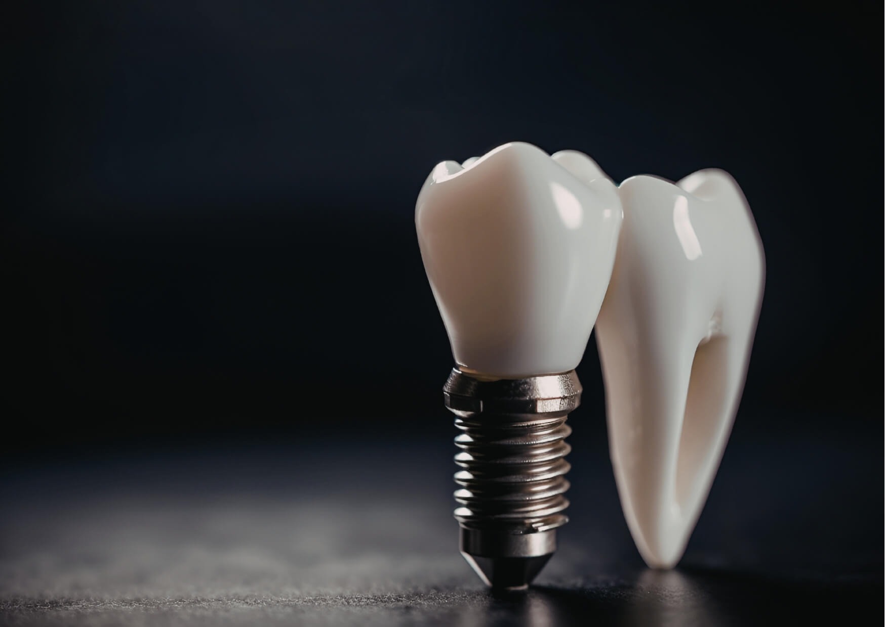 Close-up model of a dental implant restoration illustrating the components that can influence the overall cost of dental implants