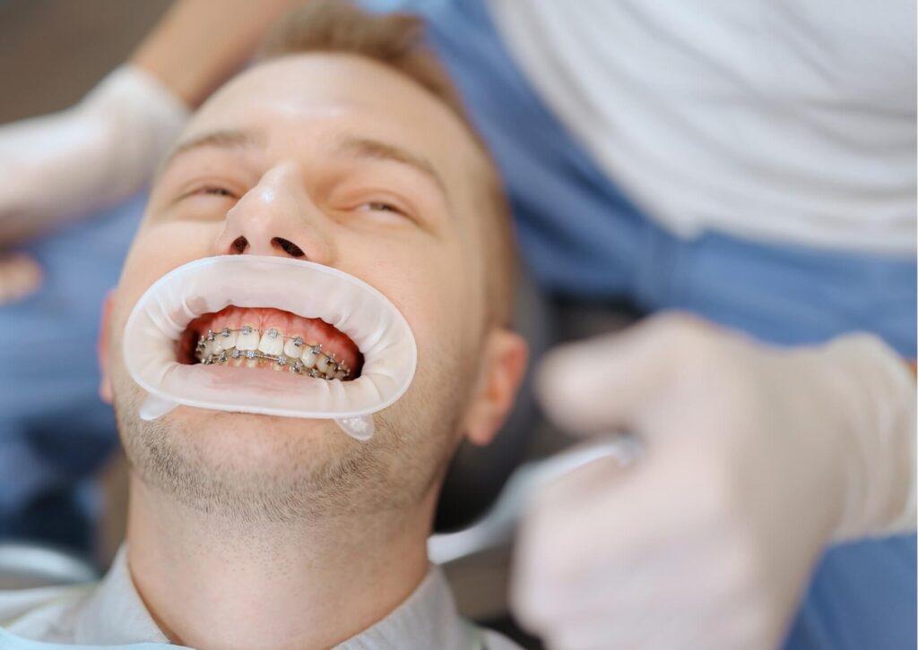 Patient wearing braces during an orthodontic checkup to discuss how eating candies with braces can affect brackets and wires.